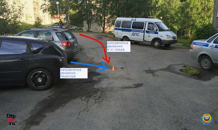 Костомукша, 10 августа 2015 года, 18-15. ДТП с участием ребенка легкового автомобиля Мазда (Mazda) произошло на улице Мира, во дворе дома №20.
